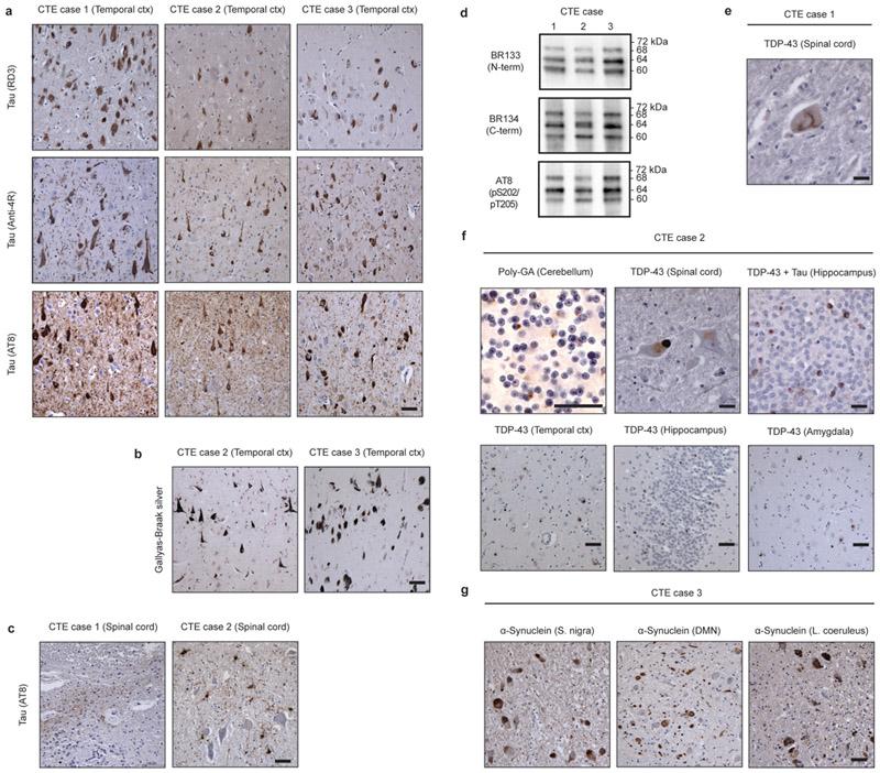 https://cdn.ncbi.nlm.nih.gov/pmc/blobs/a22f/6472968/c3f9f889f94c/nihms-1522205-f0004.jpg