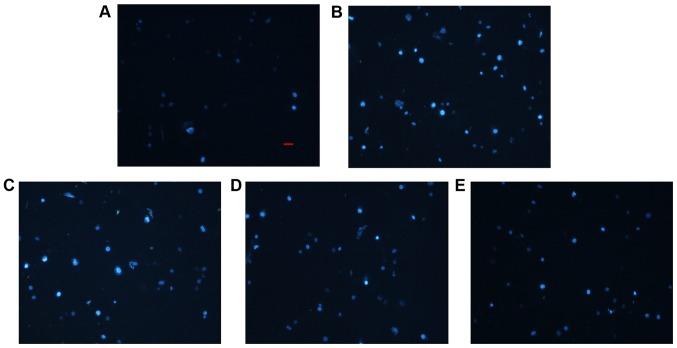 https://cdn.ncbi.nlm.nih.gov/pmc/blobs/a231/6297788/93763e5b3a00/MMR-19-01-0432-g02.jpg