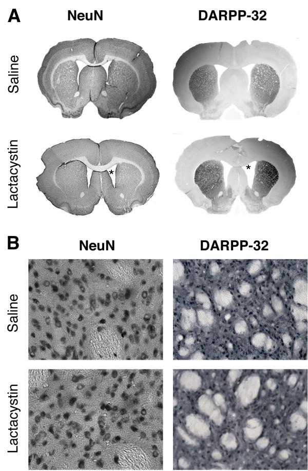 https://cdn.ncbi.nlm.nih.gov/pmc/blobs/a233/2824797/876ee07d88cf/1471-2202-11-1-6.jpg