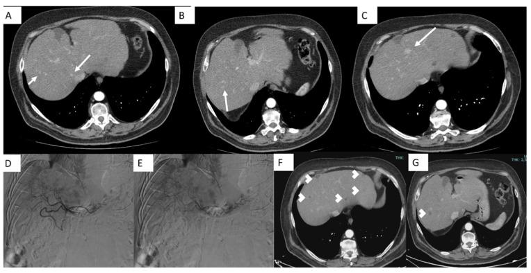 https://cdn.ncbi.nlm.nih.gov/pmc/blobs/a237/11766109/a6930dbaa19a/jcm-14-00314-g003.jpg