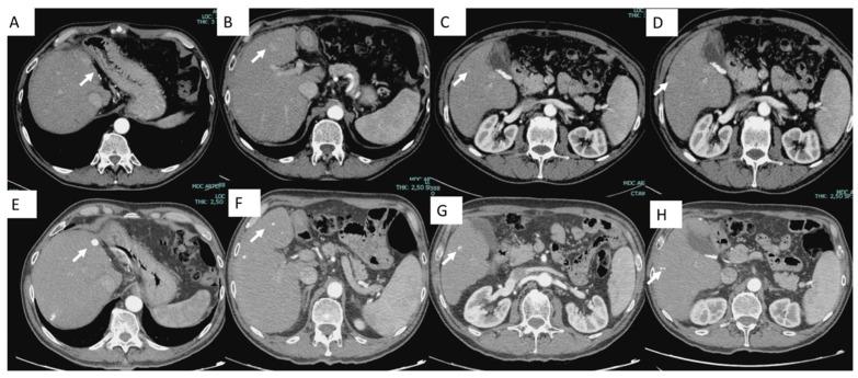 https://cdn.ncbi.nlm.nih.gov/pmc/blobs/a237/11766109/eb75a29ae5ca/jcm-14-00314-g002.jpg