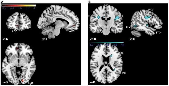 https://cdn.ncbi.nlm.nih.gov/pmc/blobs/a239/3569458/39a64b21b659/pone.0055619.g004.jpg