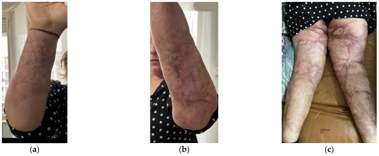 https://cdn.ncbi.nlm.nih.gov/pmc/blobs/a241/11852087/3603c592b258/bioengineering-12-00179-g001.jpg