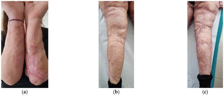 https://cdn.ncbi.nlm.nih.gov/pmc/blobs/a241/11852087/e981c48ed2e7/bioengineering-12-00179-g013.jpg