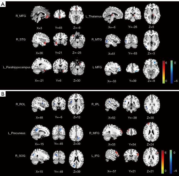 https://cdn.ncbi.nlm.nih.gov/pmc/blobs/a242/12397636/e6ed5727b08e/qims-15-09-7820-f2.jpg