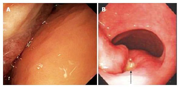 https://cdn.ncbi.nlm.nih.gov/pmc/blobs/a243/5558125/862c90013e55/WJG-23-5619-g001.jpg