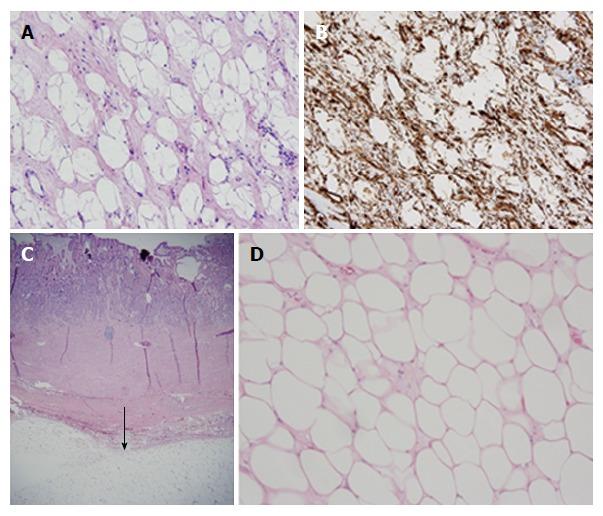 https://cdn.ncbi.nlm.nih.gov/pmc/blobs/a243/5558125/b6a88d471eb9/WJG-23-5619-g004.jpg