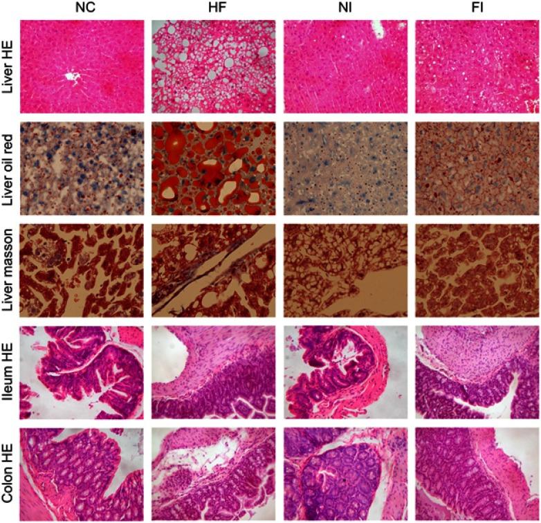 https://cdn.ncbi.nlm.nih.gov/pmc/blobs/a243/6617567/5cf568baf2a9/DDDT-13-2249-g0002.jpg