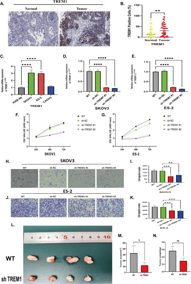 https://cdn.ncbi.nlm.nih.gov/pmc/blobs/a245/12084907/6988c1840ef6/12905_2025_3750_Fig13_HTML.jpg
