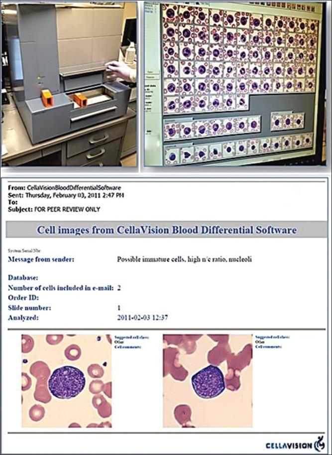 https://cdn.ncbi.nlm.nih.gov/pmc/blobs/a248/3551511/8cc254284d95/JPI-3-45-g002.jpg