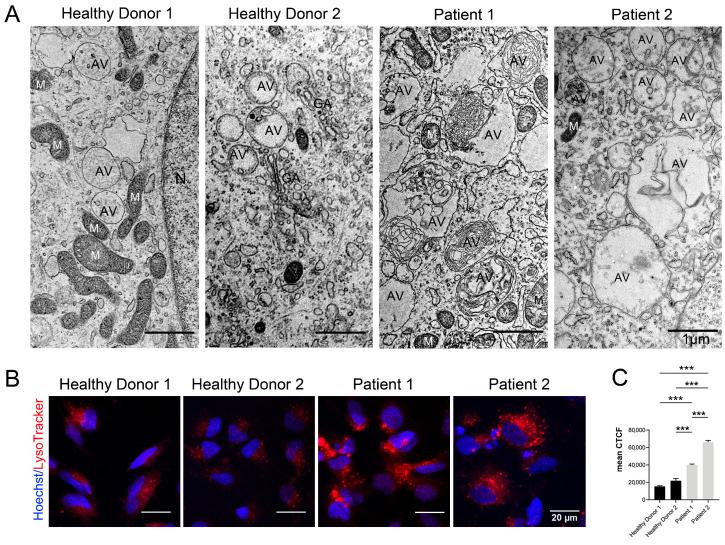 https://cdn.ncbi.nlm.nih.gov/pmc/blobs/a24a/10705360/cd4e04198bc9/cells-12-02702-g005.jpg