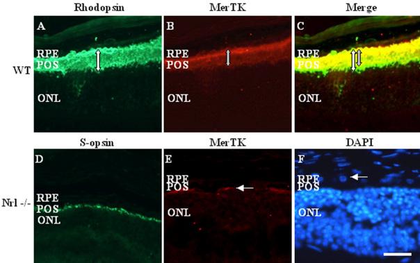 https://cdn.ncbi.nlm.nih.gov/pmc/blobs/a253/3013069/6489c92c504a/mv-v16-2873-f4.jpg