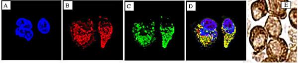 https://cdn.ncbi.nlm.nih.gov/pmc/blobs/a25e/1484490/612a80869e76/1476-4598-5-14-1.jpg