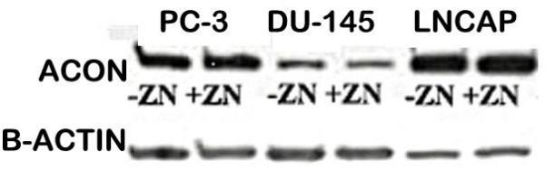 https://cdn.ncbi.nlm.nih.gov/pmc/blobs/a25e/1484490/cdd57923284c/1476-4598-5-14-3.jpg
