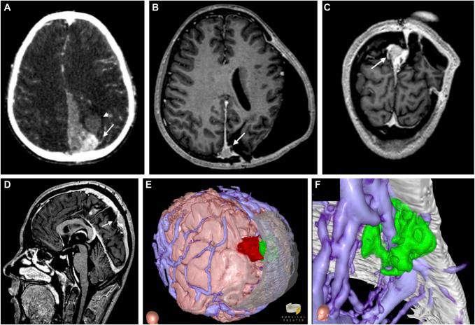 https://cdn.ncbi.nlm.nih.gov/pmc/blobs/a25f/11809979/31ebe7d37f9b/neuopen-4-e00038-g001.jpg