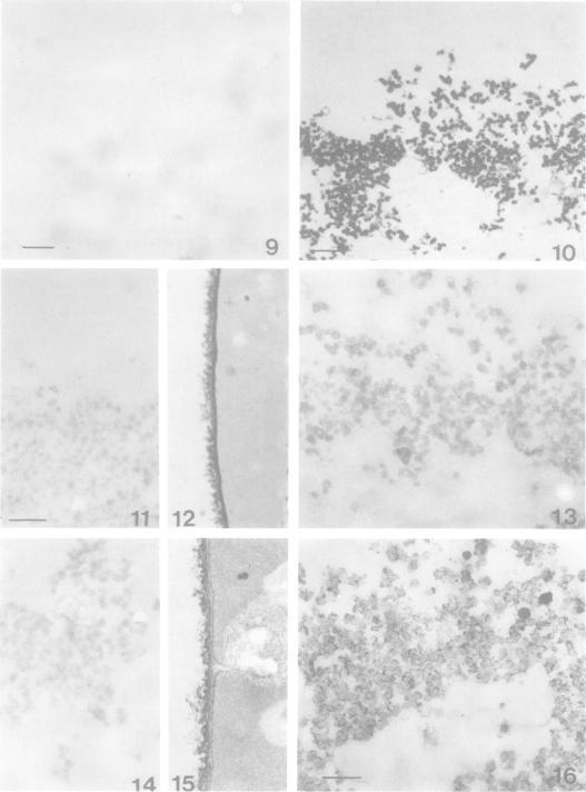 https://cdn.ncbi.nlm.nih.gov/pmc/blobs/a263/218379/9b9969d557ee/jbacter00285-0258-a.jpg