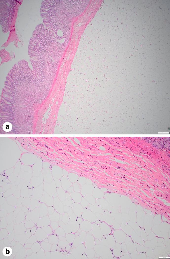 https://cdn.ncbi.nlm.nih.gov/pmc/blobs/a267/10776135/a4402921bceb/crg-2024-0018-0001-534973_F04.jpg