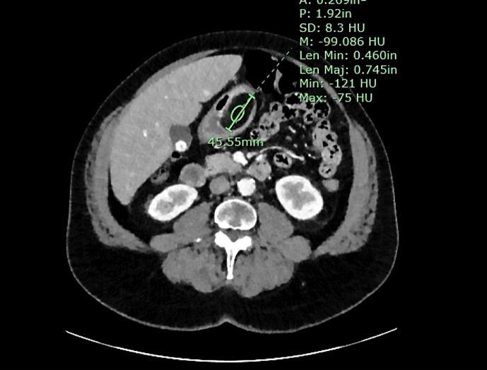 https://cdn.ncbi.nlm.nih.gov/pmc/blobs/a267/10776135/b3a218f1b23f/crg-2024-0018-0001-534973_F01.jpg