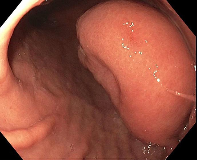 https://cdn.ncbi.nlm.nih.gov/pmc/blobs/a267/10776135/d7e506be9d2b/crg-2024-0018-0001-534973_F02.jpg