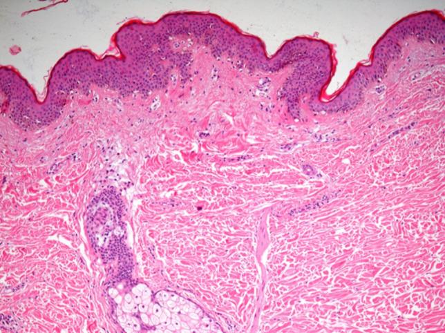 https://cdn.ncbi.nlm.nih.gov/pmc/blobs/a271/11333785/e0d2b610adee/40477_2024_925_Fig6_HTML.jpg