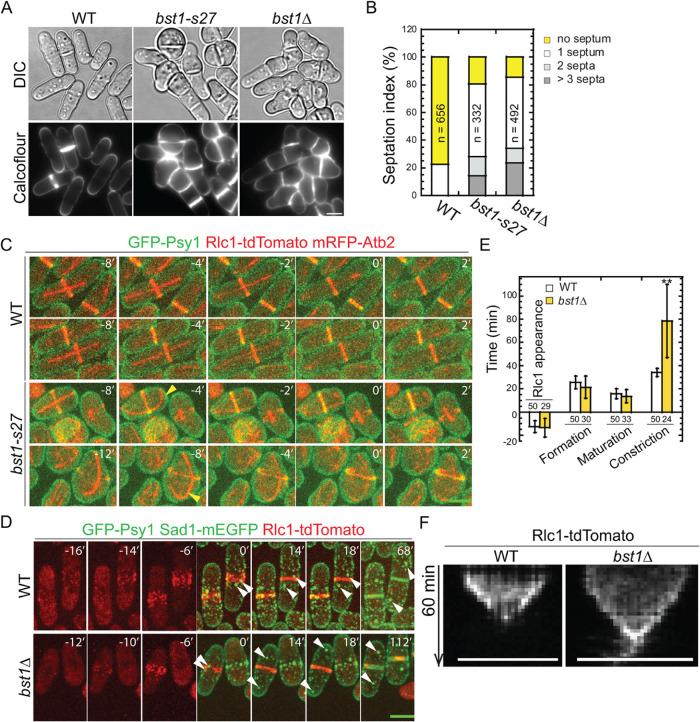 https://cdn.ncbi.nlm.nih.gov/pmc/blobs/a272/11974966/85704e2787dd/mbc-36-br11-g002.jpg