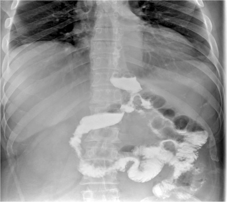 https://cdn.ncbi.nlm.nih.gov/pmc/blobs/a275/6018596/5e473156b5fa/11695_2018_3241_Fig6_HTML.jpg