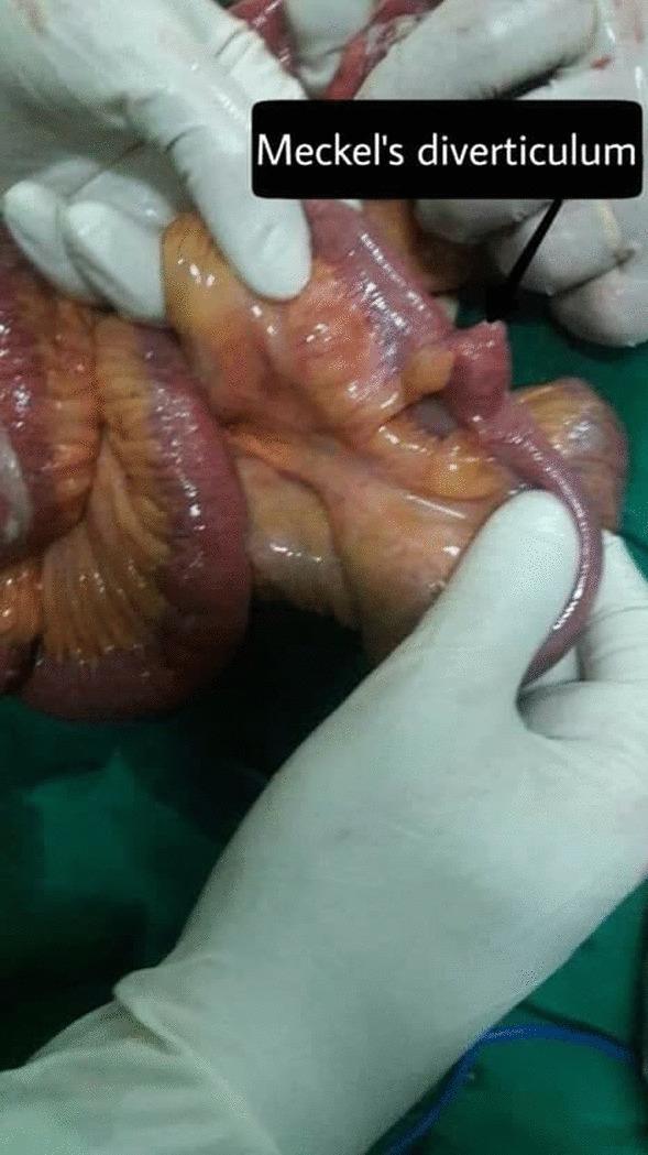 https://cdn.ncbi.nlm.nih.gov/pmc/blobs/a27c/8932322/fe12db91afee/12893_2022_1541_Fig6_HTML.jpg