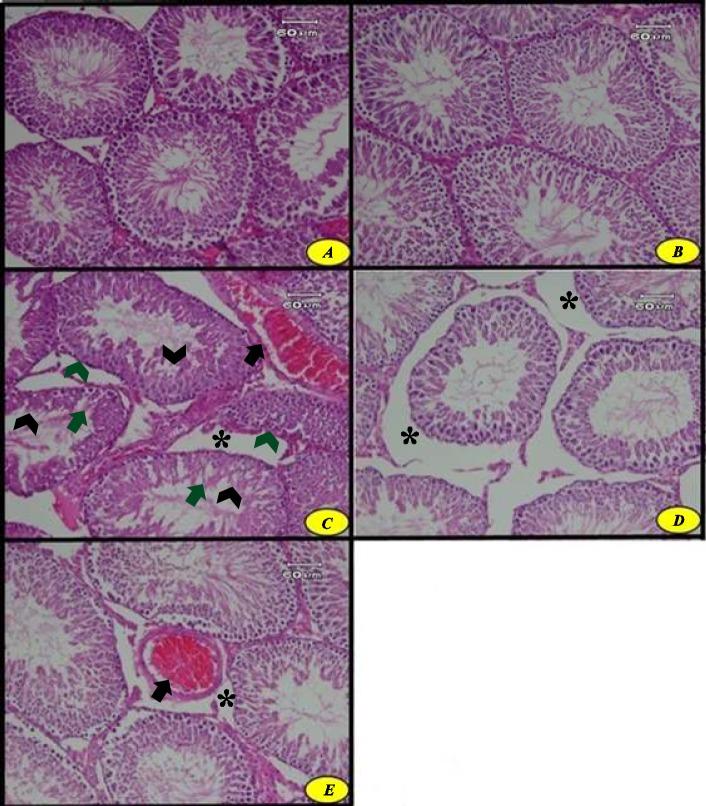 https://cdn.ncbi.nlm.nih.gov/pmc/blobs/a27d/6396992/ede3dec1c8c5/IJBMS-22-197-g006.jpg