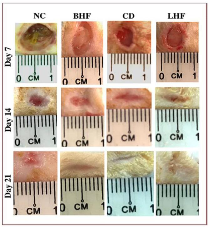 https://cdn.ncbi.nlm.nih.gov/pmc/blobs/a282/12026876/e88c3dd7cea7/gels-11-00271-g007.jpg