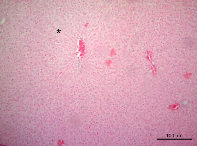 https://cdn.ncbi.nlm.nih.gov/pmc/blobs/a289/10440976/486fa6be986d/eajm-55-2-104_f004.jpg