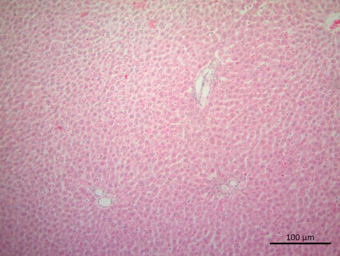 https://cdn.ncbi.nlm.nih.gov/pmc/blobs/a289/10440976/d4f7a4a41506/eajm-55-2-104_f002.jpg