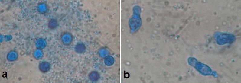 https://cdn.ncbi.nlm.nih.gov/pmc/blobs/a28d/9508644/5d5ef7471a0a/gr1.jpg
