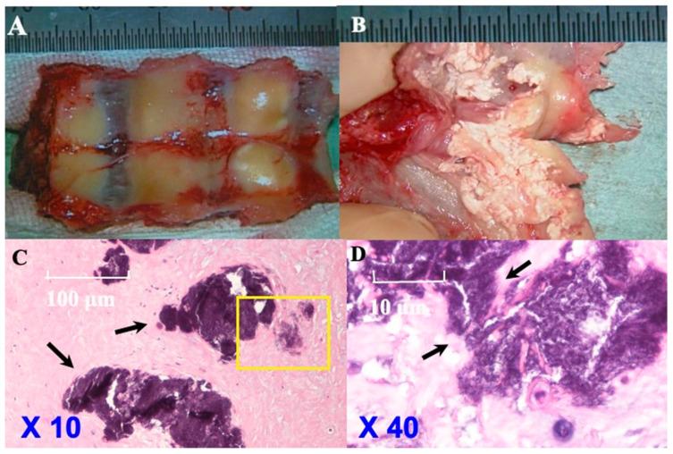 https://cdn.ncbi.nlm.nih.gov/pmc/blobs/a296/10780021/3ad1ad25c9a7/jcm-13-00105-g007.jpg
