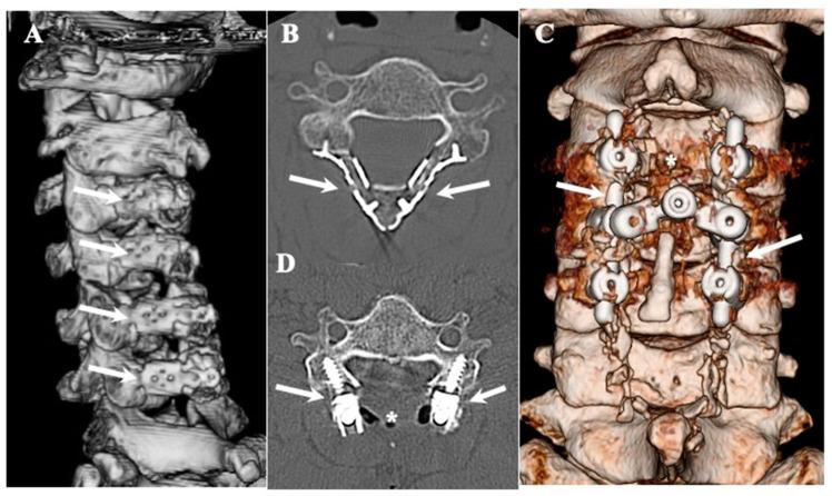 https://cdn.ncbi.nlm.nih.gov/pmc/blobs/a296/10780021/47fa230f10bd/jcm-13-00105-g001.jpg