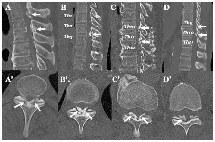 https://cdn.ncbi.nlm.nih.gov/pmc/blobs/a296/10780021/778fbd85e886/jcm-13-00105-g005.jpg