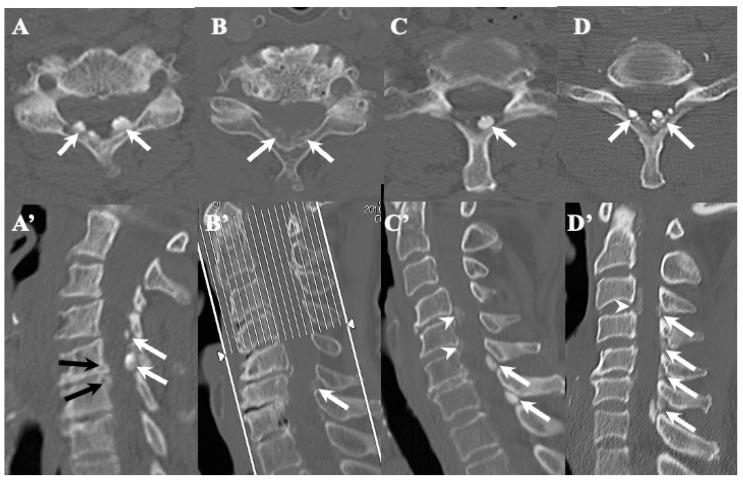 https://cdn.ncbi.nlm.nih.gov/pmc/blobs/a296/10780021/7ecd9d129b44/jcm-13-00105-g003.jpg