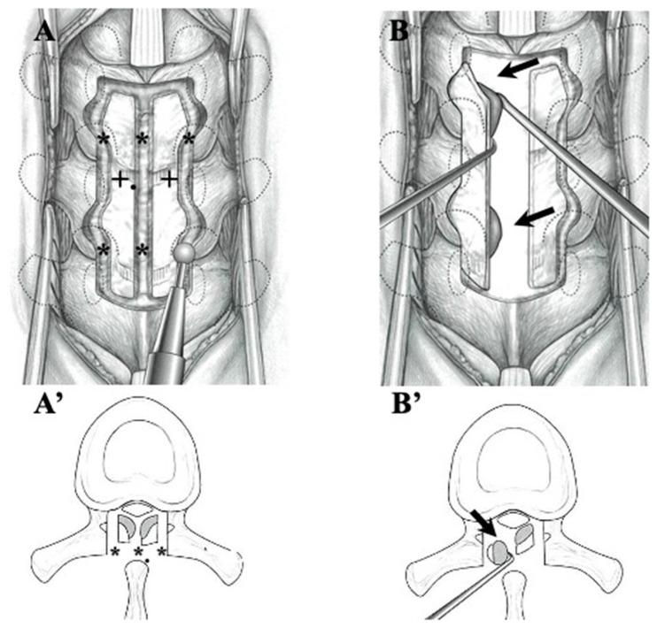 https://cdn.ncbi.nlm.nih.gov/pmc/blobs/a296/10780021/c7bfe31508db/jcm-13-00105-g002.jpg