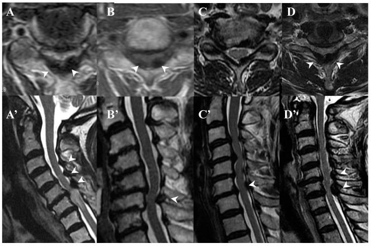 https://cdn.ncbi.nlm.nih.gov/pmc/blobs/a296/10780021/d16564d39850/jcm-13-00105-g004.jpg