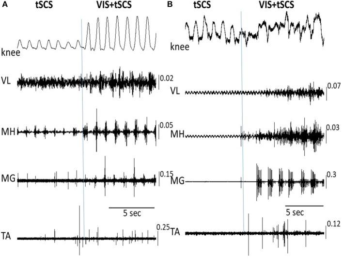 https://cdn.ncbi.nlm.nih.gov/pmc/blobs/a29a/6157483/2ee9b3c9bb4c/fphys-09-01196-g0004.jpg
