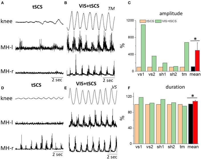 https://cdn.ncbi.nlm.nih.gov/pmc/blobs/a29a/6157483/7e3194ac9f01/fphys-09-01196-g0003.jpg
