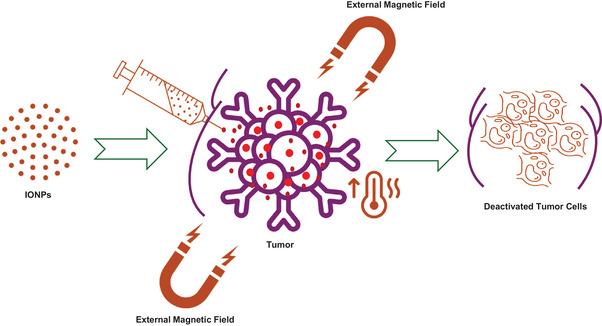 https://cdn.ncbi.nlm.nih.gov/pmc/blobs/a29d/11804848/37587370f7a3/ADHM-14-0-g018.jpg