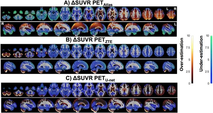 https://cdn.ncbi.nlm.nih.gov/pmc/blobs/a29e/6779234/d80acd1870a3/pone.0223141.g004.jpg