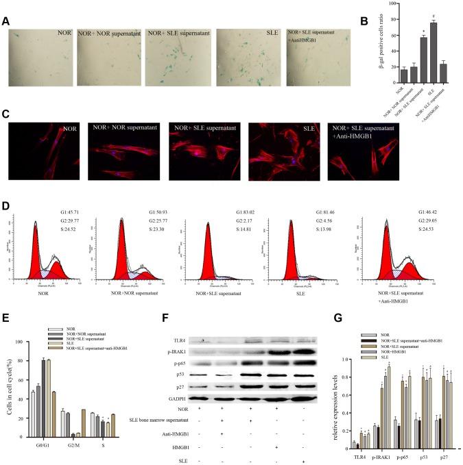 https://cdn.ncbi.nlm.nih.gov/pmc/blobs/a2a0/6660056/bf2be98cd6d5/aging-11-102052-g002.jpg