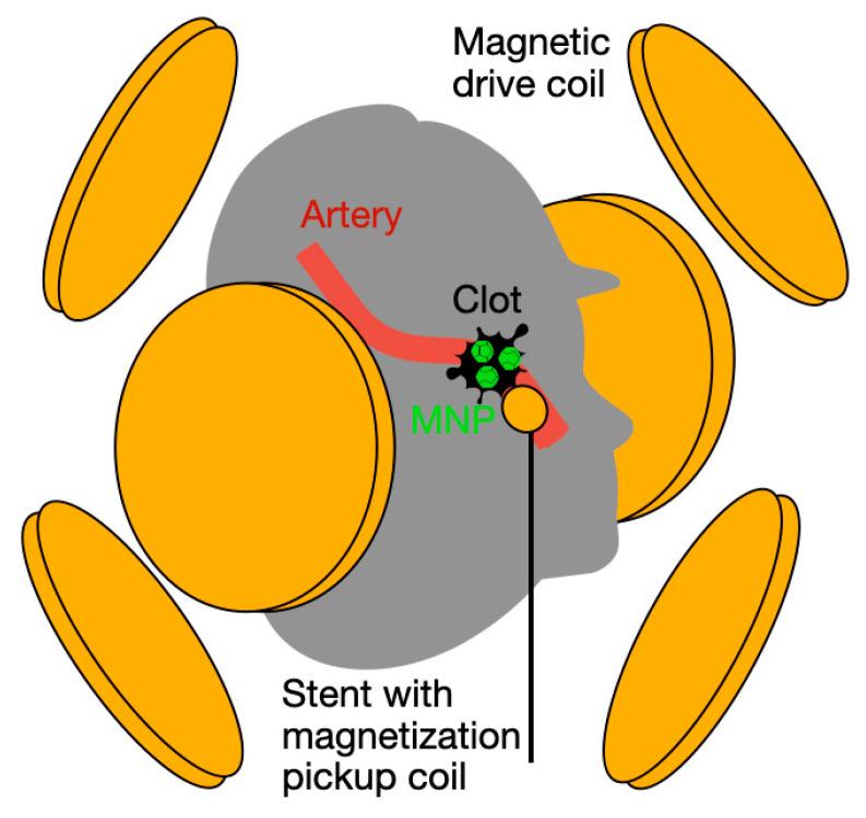 https://cdn.ncbi.nlm.nih.gov/pmc/blobs/a2a3/11820568/5e98a254ff7d/sensors-25-00672-g001.jpg