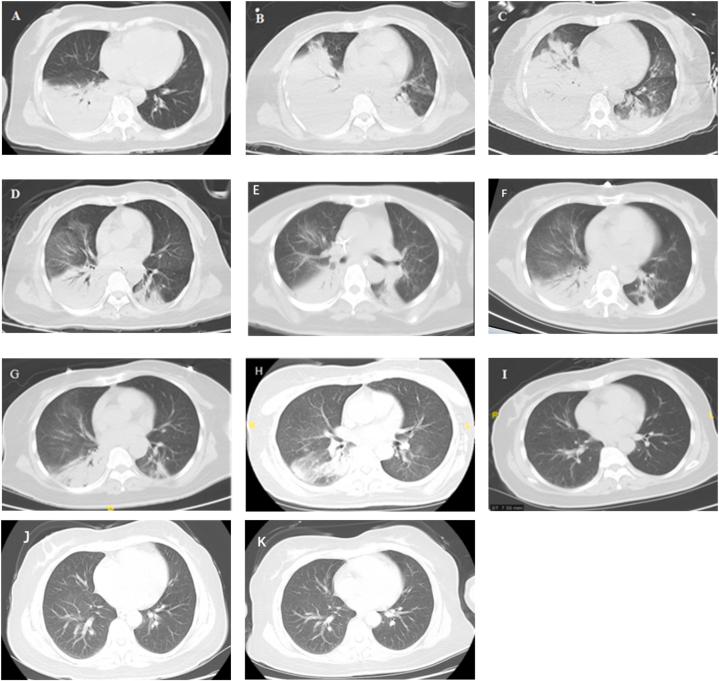 https://cdn.ncbi.nlm.nih.gov/pmc/blobs/a2a4/10568334/f92bc663aa77/gr1.jpg