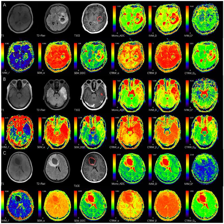 https://cdn.ncbi.nlm.nih.gov/pmc/blobs/a2a5/12344946/c2d8ab9e5f90/fonc-15-1551023-g001.jpg