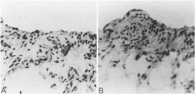 https://cdn.ncbi.nlm.nih.gov/pmc/blobs/a2a7/1877661/5b9dc701800f/amjpathol00107-0024-b.jpg