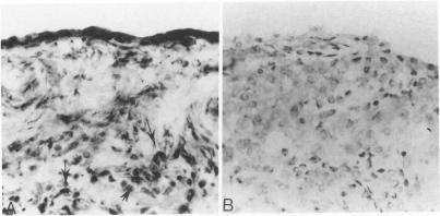 https://cdn.ncbi.nlm.nih.gov/pmc/blobs/a2a7/1877661/cd474c241dc0/amjpathol00107-0024-a.jpg