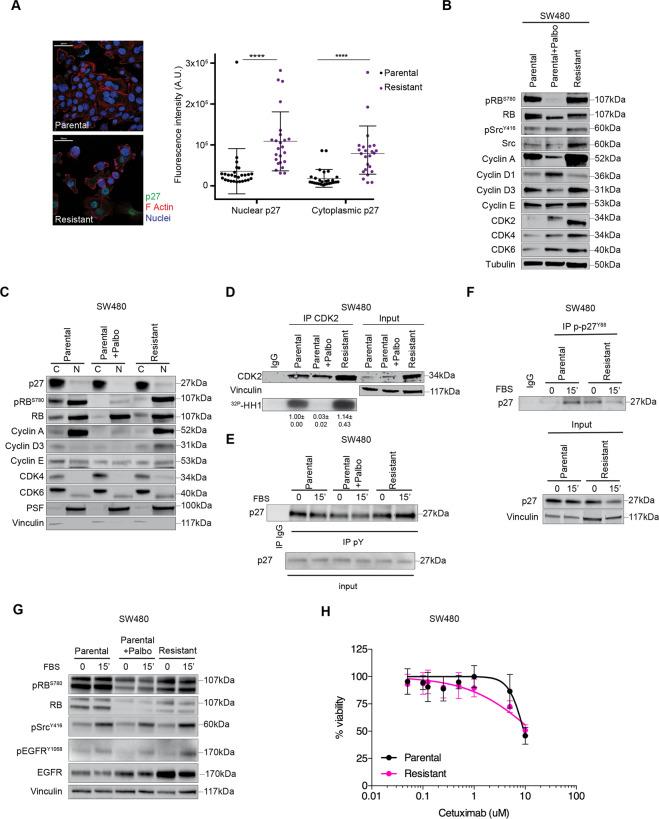 https://cdn.ncbi.nlm.nih.gov/pmc/blobs/a2ad/8519959/dd47e30fb31b/41419_2021_4241_Fig4_HTML.jpg