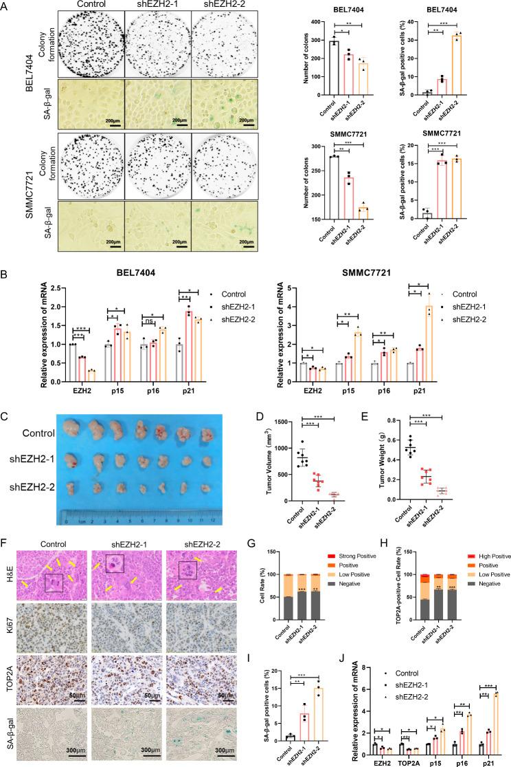 https://cdn.ncbi.nlm.nih.gov/pmc/blobs/a2ae/10680220/06b5cc862d11/13046_2023_2855_Fig5_HTML.jpg